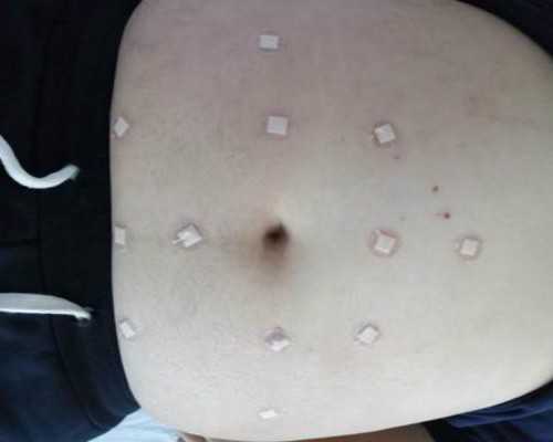 三代试管婴儿供卵_捐卵供卵交流群,北京供卵试管费用都包含什么