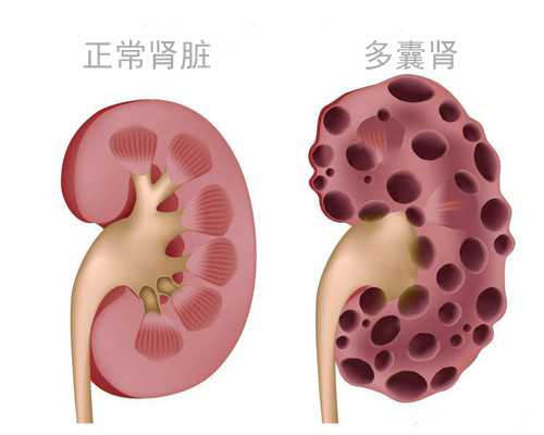 三亚做供卵试管婴儿费用多少