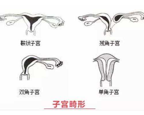 供卵推广_卵巢早衰供卵价格,攀枝花供卵试管成功经历bg